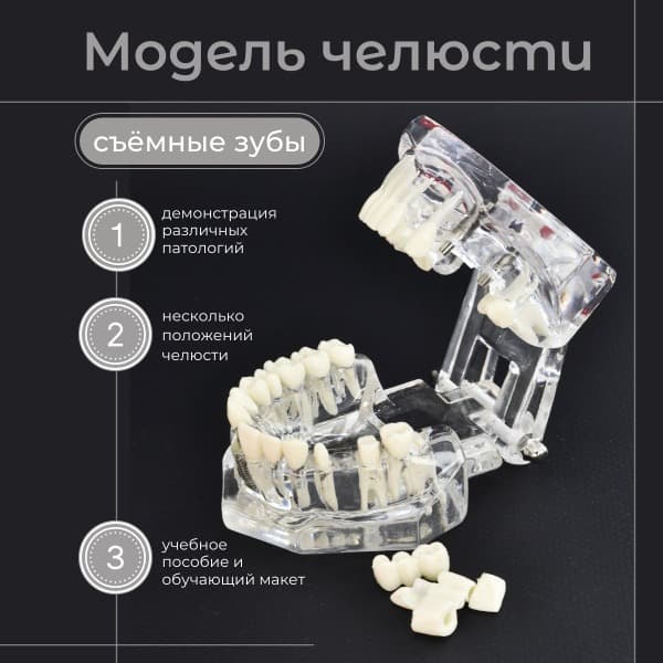 Dental Jaw Model with Pathologies