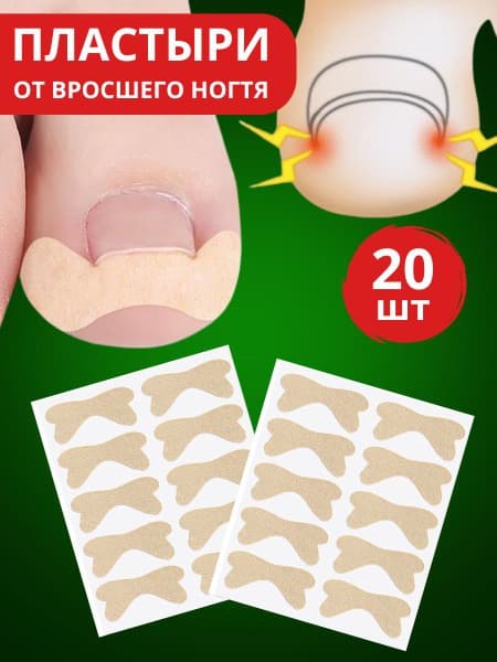Ingrown Toenail Patch: Prevention &amp; Treatment