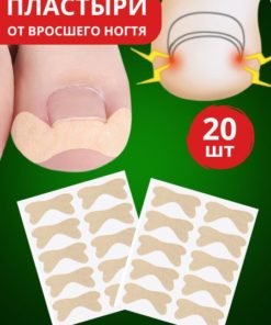 Ingrown Toenail Patch: Prevention & Treatment