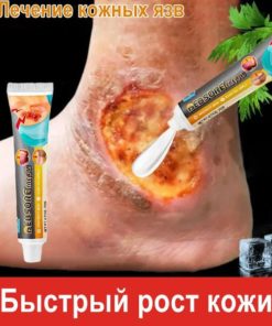 Pressure Sore Treatment Gel: 20g Nanyu