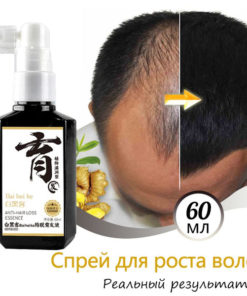 Hair Growth Spray & Anti-Hair Loss Treatment (60ml) - Natural Extracts