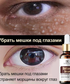 Retinol Eye Cream: Anti-Aging Lift, Reduces Wrinkles, Puffiness & Dark Circles (30ml)
