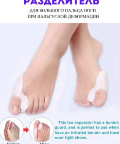 Bunion Corrector: Valgus Splint for Big Toe