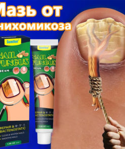 Onychomycosis Cream 30g: Painless Treatment for Thick, Yellow & Gray Toenails