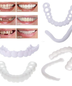 Veneers: Upper & Lower with NP Attachment