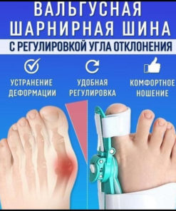 Adjustable Ankle-Foot Orthoses for Clubfoot Correction