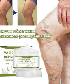 Varicose Veins Cream: Effective Relief for Swelling, Pain & Fatigue (50g)
