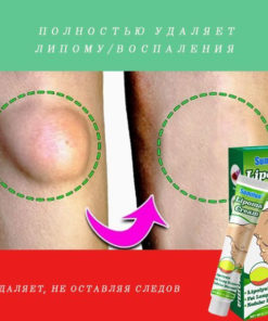 Lipoma Removal Cream: Eliminate Fat Deposits & Subcutaneous Lumps (20g)