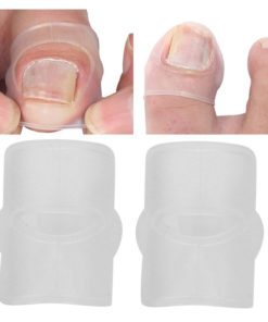 Ingrown Toenail Correction