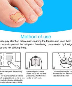 Self-Adhesive Orthotic Nail Stickers