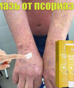 Effective Chinese Ointment for Psoriasis, Ringworm, Eczema, Dermatitis, Herpes, Acne (20g)