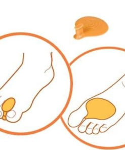 Metatarsal Cushion: Pain Relief & Correction