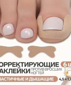 Ingrown Toenail Corrector Kit (6pcs, Beige)