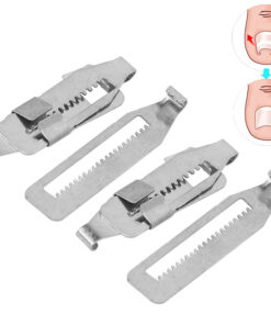 Ingrown Toenail Correction