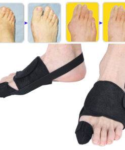 Valgus Deformity Corrector: Foot Pain Relief & Alignment