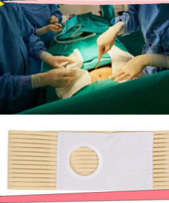 Ostomy Belt: Medical Support & Comfort