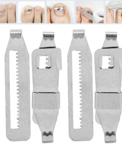 Ingrown Toenail Corrector