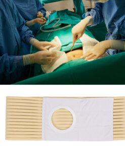 Stoma Belt Medical Support