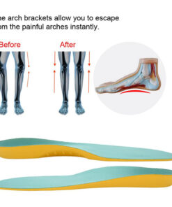 Children's Orthopedic Insoles for Flat Feet & Bow Legs: Arch Support, Prevention, Size S
