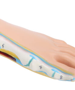 Human Foot Model: Flat Feet Diagnosis & Treatment
